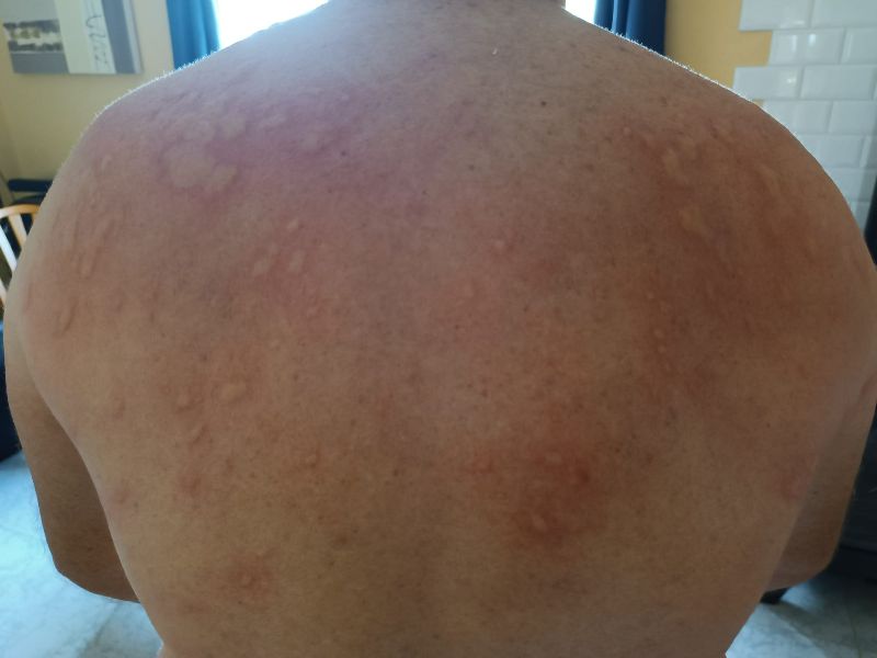 El PP solicita medidas urgentes para combatir la plaga de&nbsp;mosquitos